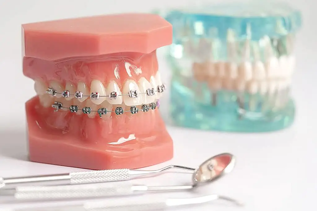Dentist equipment dental instrument tools for dental professionals metal braces in Prosper or Colleyville, TX