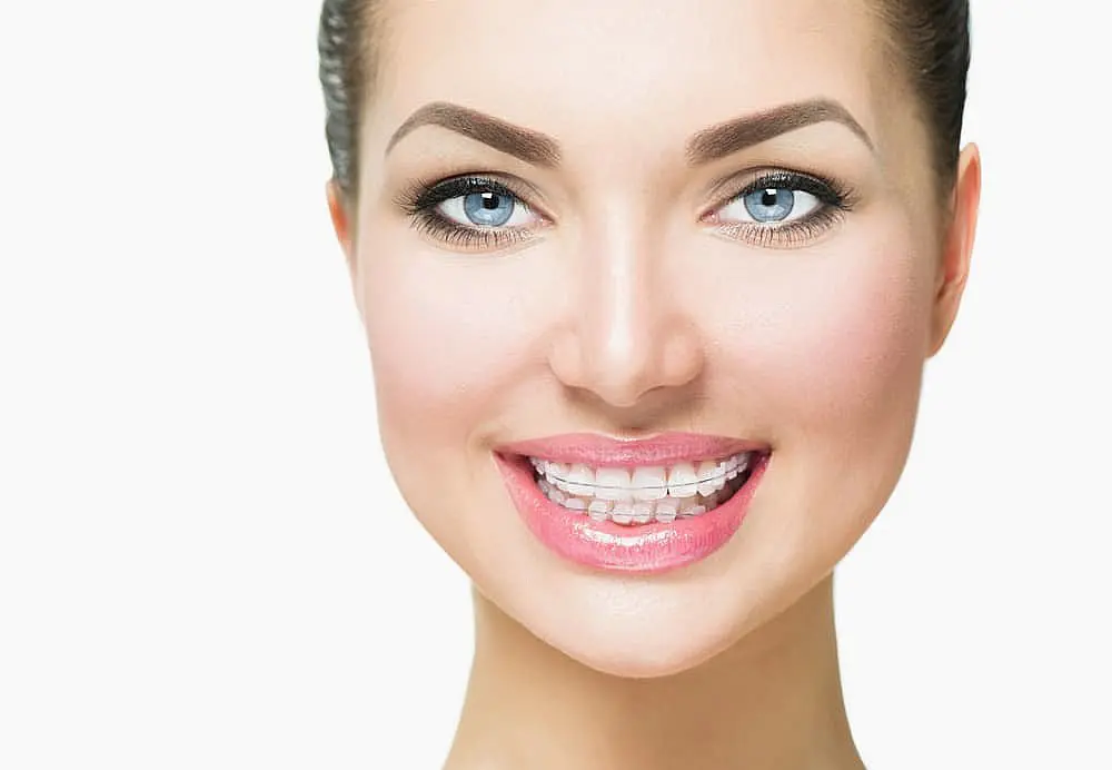 A woman smiles against a white background, displaying the discreet appearance of clear ceramic braces from Wink Orthodontics in Colleyville, TX.
