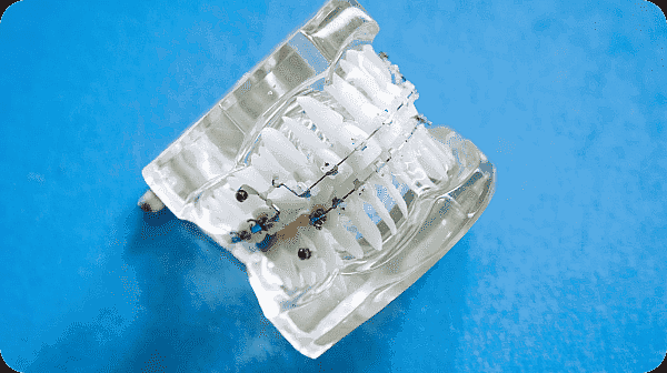 Component of metal braces in Prosper or Colleyville, TX